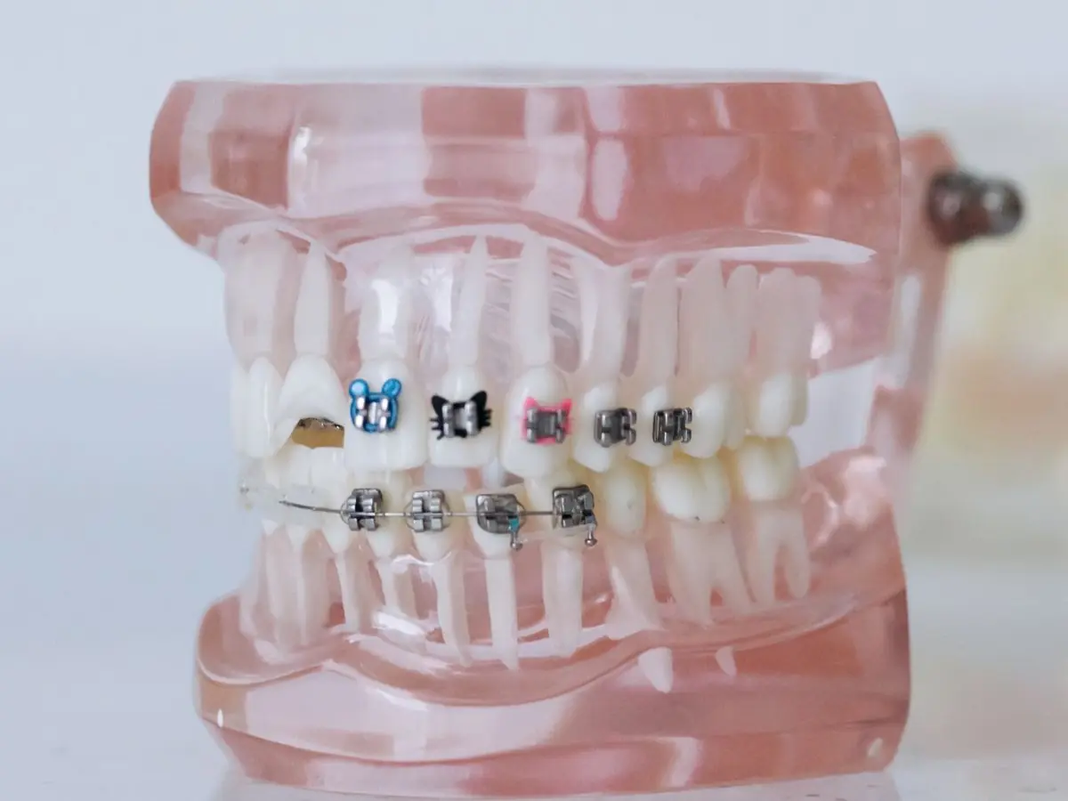Braces & Orthodontics