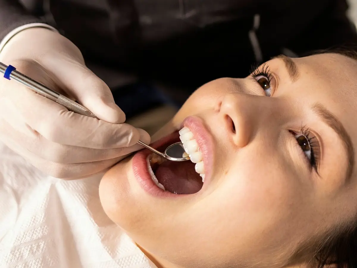 Dental Cleaning & Polishing